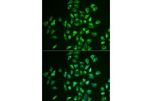 Immunofluorescence analysis of U2OS cells using LNX1 antibody (ABIN5973876). (LNX1 Antikörper)