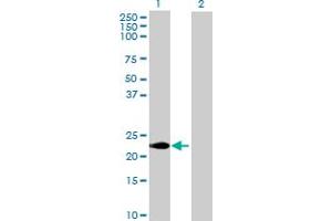 Western Blot analysis of CABP7 expression in transfected 293T cell line by CABP7 MaxPab polyclonal antibody. (CABP7 Antikörper  (AA 1-215))