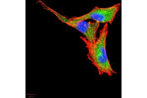 Immunocytochemistry (ICC) image for anti-Colony Stimulating Factor 3 (Granulocyte) (CSF3) (AA 1-207) antibody (ABIN5863249) (G-CSF Antikörper  (AA 1-207))