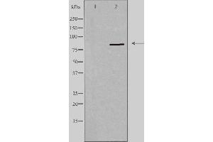 Western blot analysis of extracts from HeLa cells using PNPLA8 antibody. (PNPLA8 Antikörper  (C-Term))