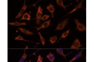 Immunofluorescence analysis of L929 cells using RPL24 Polyclonal Antibody at dilution of 1:100 (40x lens). (RPL24 Antikörper)