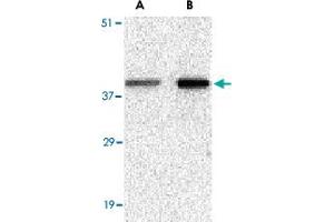 Western blot analysis of BCL2A1 in mouse kidney tissue lysate with BCL2A1 polyclonal antibody  at (A) 1 and (B) 2 ug/mL . (BCL2A1 Antikörper  (N-Term))