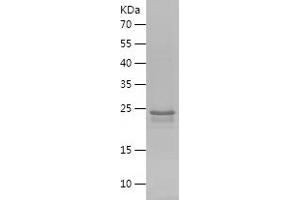 Western Blotting (WB) image for Islet Amyloid Polypeptide (IAPP) (AA 34-70) protein (His-IF2DI Tag) (ABIN7283285) (Amylin/DAP Protein (AA 34-70) (His-IF2DI Tag))