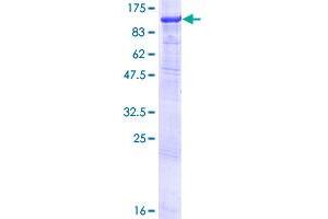 Glycogen Synthase 1 Protein (AA 1-737) (GST tag)