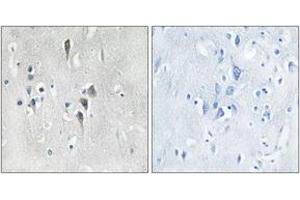 Immunohistochemistry analysis of paraffin-embedded human brain tissue, using CaMK2 alpha/delta (Ab-286) Antibody. (CaMK2 alpha/delta Antikörper  (AA 256-305))