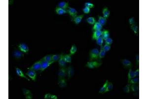 Immunofluorescence staining of Hela cells with ABIN7150034 at 1:133, counter-stained with DAPI. (A Disintegrin and Metallopeptidase Domain 1a (ADAM1A) (AA 214-504) Antikörper)