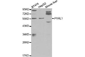 Western blot analysis of extracts of various cell lines, using PVRL1 antibody (ABIN5971069) at 1/1000 dilution. (PVRL1 Antikörper)