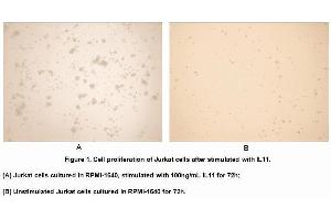 Image no. 1 for Interleukin 11 (IL11) (AA 22-199) (Active) protein (His tag) (ABIN6239760) (IL-11 Protein (AA 22-199) (His tag))