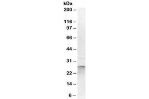 Western blot testing of human cerebellum lysate with OTUB2 antibody at 1ug/ml. (OTUB2 Antikörper)