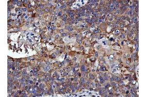 IHC analysis of RRS1 using anti-RRS1 antibody (ABIN7602918). (RRS1 Antikörper  (C-Term))