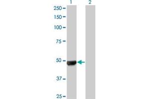 Western Blot analysis of UBR2 expression in transfected 293T cell line by UBR2 monoclonal antibody (M01), clone 4G4.