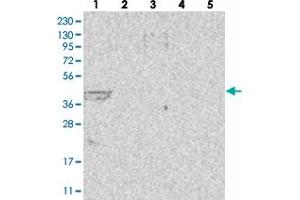 Western blot analysis of Lane 1: RT-4, Lane 2: U-251 MG, Lane 3: Human Plasma, Lane 4: Liver, Lane 5: Tonsil with LIPT1 polyclonal antibody . (LIPT1 Antikörper)