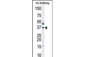 Deoxyguanosine Kinase Antikörper  (N-Term)