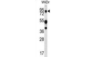 Western Blotting (WB) image for anti-Mucin 20, Cell Surface Associated (MUC20) antibody (ABIN2995266)