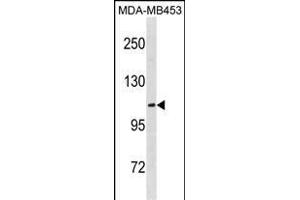 EN Antibody (C-term) (ABIN1881297 and ABIN2838760) western blot analysis in MDA-M cell line lysates (35 μg/lane). (ENPP3 Antikörper  (C-Term))