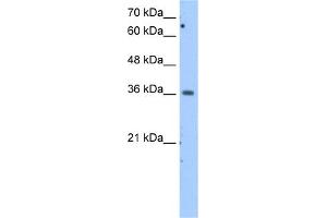 WB Suggested Anti-MDH1 Antibody Titration:  2. (MDH1 Antikörper  (Middle Region))