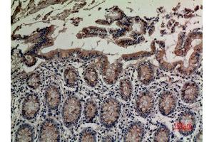 Immunohistochemistry (IHC) analysis of paraffin-embedded Human Colon, antibody was diluted at 1:100.