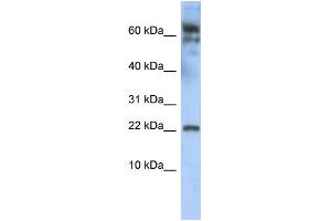 WB Suggested Anti-LDOC1 Antibody Titration:  0.