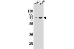 Western Blotting (WB) image for anti-Ectonucleoside Triphosphate diphosphohydrolase 3 (ENTPD3) antibody (ABIN2995799) (ENTPD3 Antikörper)