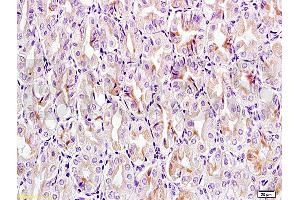 Formalin-fixed and paraffin embedded mouse stomach tissue labeled with Anti-CCL24 Polyclonal Antibody, Unconjugated (ABIN740925) at 1:200 followed by conjugation to the secondary antibody, (SP-0023), and DAB staining (CCL24 Antikörper  (AA 27-119))