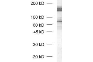 dilution: 1 : 1000, sample: rat brain honogenate (unboiled sample) (Neurexin 1 Antikörper  (AA 1328-1421))