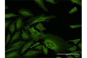 Immunofluorescence of purified MaxPab antibody to CAP1 on HeLa cell. (CAP1 Antikörper  (AA 1-475))