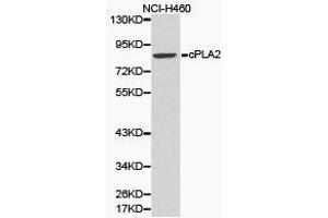 Western Blotting (WB) image for anti-Phospholipase A2, Group IVA (Cytosolic, Calcium-Dependent) (PLA2G4A) antibody (ABIN1874154) (PLA2G4A Antikörper)