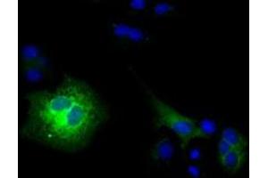 Anti-CD80 mouse monoclonal antibody (ABIN2452897) immunofluorescent staining of COS7 cells transiently transfected by pCMV6-ENTRY CD80 (RC206540). (CD80 Antikörper)