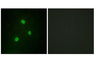 Immunofluorescence analysis of A549 cells, using TBX1 antibody. (T-Box 1 Antikörper  (C-Term))