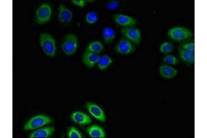 Immunofluorescent analysis of A549 cells using ABIN7153347 at dilution of 1:100 and Alexa Fluor 488-congugated AffiniPure Goat Anti-Rabbit IgG(H+L) (GPR4 Antikörper  (AA 285-362))