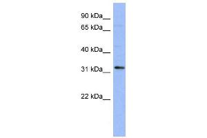 WB Suggested Anti-TLX1  Antibody Titration: 0.