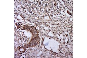 Immunohistochemistry (Paraffin-embedded Sections) (IHC (p)) image for anti-Interleukin 6 Signal Transducer (Gp130, Oncostatin M Receptor) (IL6ST) (pSer782) antibody (ABIN1714257)