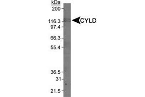 Western blot analysis of CYLD in Jurkat whole cell extract using CYLD polyclonal antibody . (CYLD Antikörper  (AA 500-600))