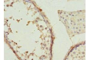 Immunohistochemistry of paraffin-embedded human testis tissue using ABIN7171416 at dilution of 1:100 (CCT2 Antikörper  (AA 206-535))