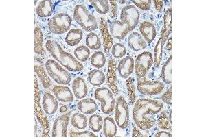 Immunohistochemistry of paraffin-embedded rat testis using PIWIL4 Rabbit pAb (ABIN6132982, ABIN6145704, ABIN6145705 and ABIN6217111) at dilution of 1:100 (40x lens). (PIWIL4 Antikörper  (AA 260-460))