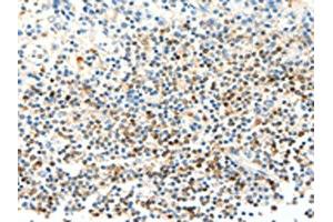The image on the left is immunohistochemistry of paraffin-embedded Human tonsil tissue using ABIN7129442(FAM3A Antibody) at dilution 1/25, on the right is treated with fusion protein. (FAM3A Antikörper)