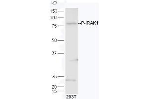 Lane 1:293T lysates probed with Rabbit Anti-IRAK1 (Thr209) Polyclonal Antibody, Unconjugated  at 1:5000 for 90 min at 37˚C. (IRAK1 Antikörper  (pThr209))