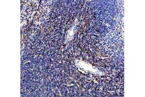 IHC analysis of CD80 using anti-CD80 antibody (ABIN5692796).