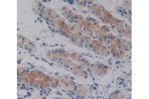 IHC-P analysis of stomach tissue, with DAB staining. (Tensin 1 Antikörper  (AA 4-307))