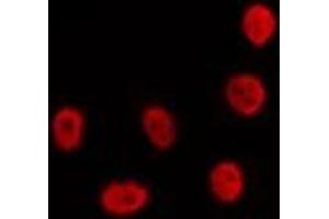 ABIN6274310 staining LOVO by IF/ICC. (CDKL1 Antikörper  (C-Term))