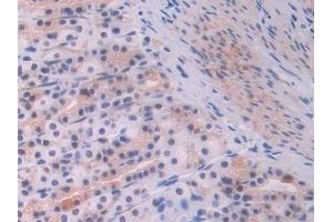 Immunohistochemistry (IHC) image for anti-Endoglin (ENG) (AA 26-136) antibody (ABIN7432976)