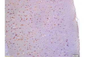 Formalin-fixed and paraffin embedded rat brain labeled with Anti-Glutamine PRPP amidotransferase Polyclonal Antibody, Unconjugated (ABIN872980) at 1:200 followed by conjugation to the secondary antibody and DAB staining (PPAT Antikörper  (AA 351-430))