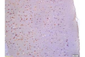 Formalin-fixed and paraffin embedded rat brain labeled with Anti-Glutamine PRPP amidotransferase Polyclonal Antibody, Unconjugated (ABIN872980) at 1:200 followed by conjugation to the secondary antibody and DAB staining