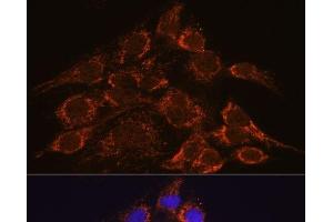 Immunofluorescence analysis of C6 cells using HPS4 Polyclonal Antibody at dilution of 1:100. (HPS4 Antikörper)