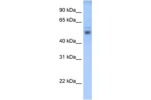 Western Blotting (WB) image for anti-STEAP Family Member 3, Metalloreductase (STEAP3) antibody (ABIN2462703) (STEAP3 Antikörper)
