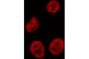 Immunofluorescence (fixed cells) (IF/ICC) image for anti-Casein Kinase 1, epsilon (CSNK1E) (Internal Region) antibody (ABIN6257584)