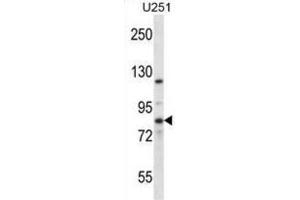 Western Blotting (WB) image for anti-Eukaryotic Translation Initiation Factor 2B, Subunit 5 Epsilon, 82kDa (EIF2B5) antibody (ABIN2997136) (EIF2B5 Antikörper)