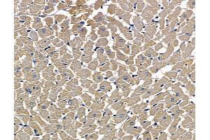 ABIN7097103 and ABIN7101170 at 1/100 staining rat heart tissue by IHC-P.