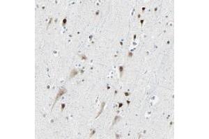 Immunohistochemical staining of human cerebral cortex with RDBP polyclonal antibody  shows strong nuclear positivity in neuronal cells at 1:200-1:500 dilution. (RDBP Antikörper)
