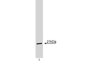 Western Blotting (WB) image for anti-Cyclin-Dependent Kinase Inhibitor 1A (p21, Cip1) (CDKN1A) antibody (ABIN967445) (p21 Antikörper)
